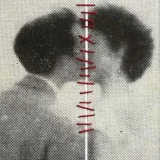 صورة قناة البرت بطرس.